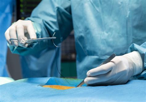 [GUIDE] SURGERY .